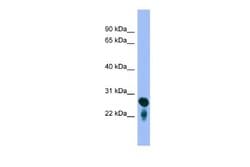 RAB5C Antibody, Novus Biologicals 100 &mu;L; Unconjugated:Antibodies, Polyclonal